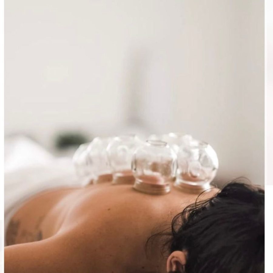 result cupping 2